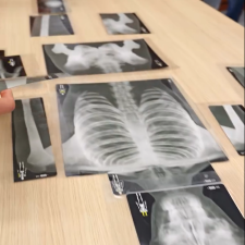 Skelettpuzzle im Klinikum Winterber